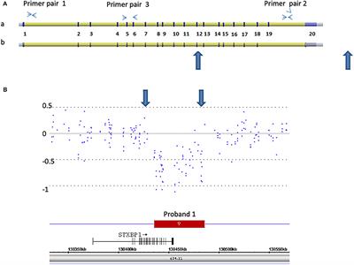 De novo STXBP1 Mutations in Two Patients With Developmental Delay With or Without Epileptic Seizures